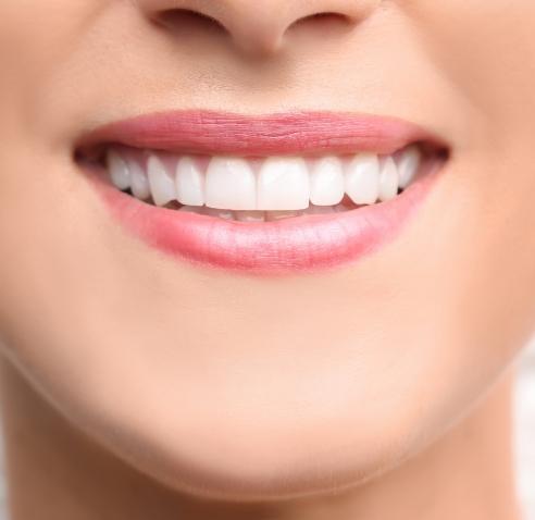 Smile with flawless white teeth