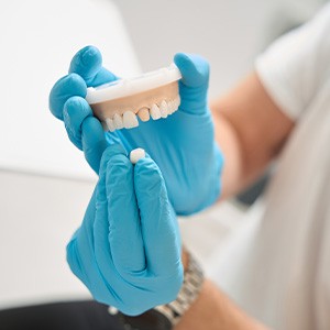Dentist showing patient how a dental crown is put in place