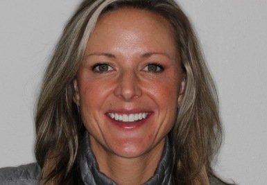 Smile with white and evenly spaced teeth