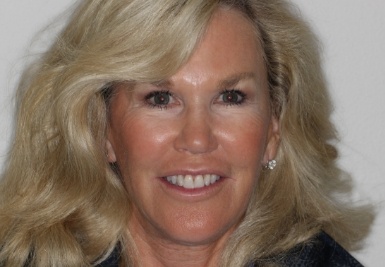 Smile with slightly gapped and discolored teeth