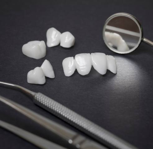 Several white dental crowns and veneers on table with dental instruments