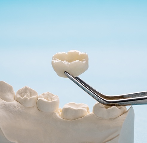 a close-up of a dental crown
