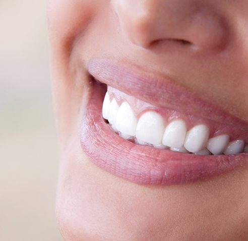 Close up of smile with flawless white teeth