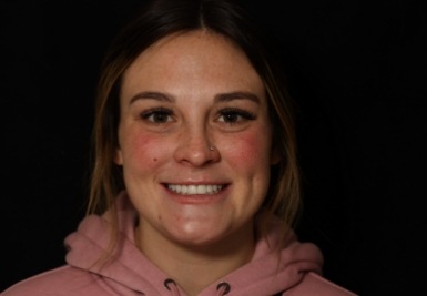 Smile with white and evenly spaced teeth